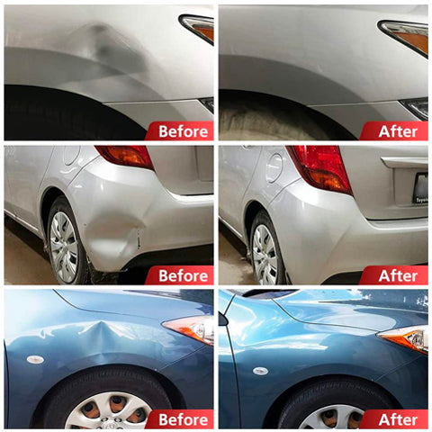 Dent Remover Tool Kit